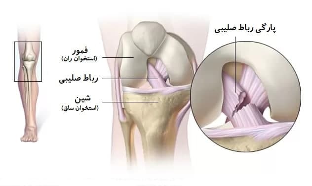 آسیب‌ها